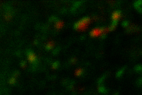 Confocal